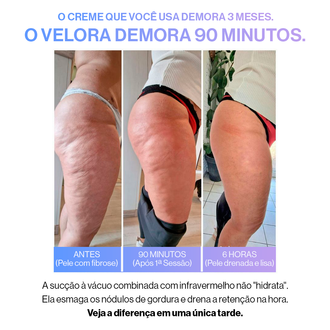 Ionique Velora | Terapia de Contorno Anticelulite | Portátil com Ventosas e Ação Térmica