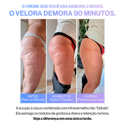 Ionique Velora | Terapia de Contorno Anticelulite | Portátil com Ventosas e Ação Térmica