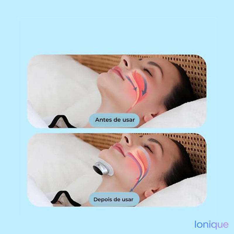 Ionique | QuietPulse – Dispositivo Anti-Ronco Inteligente