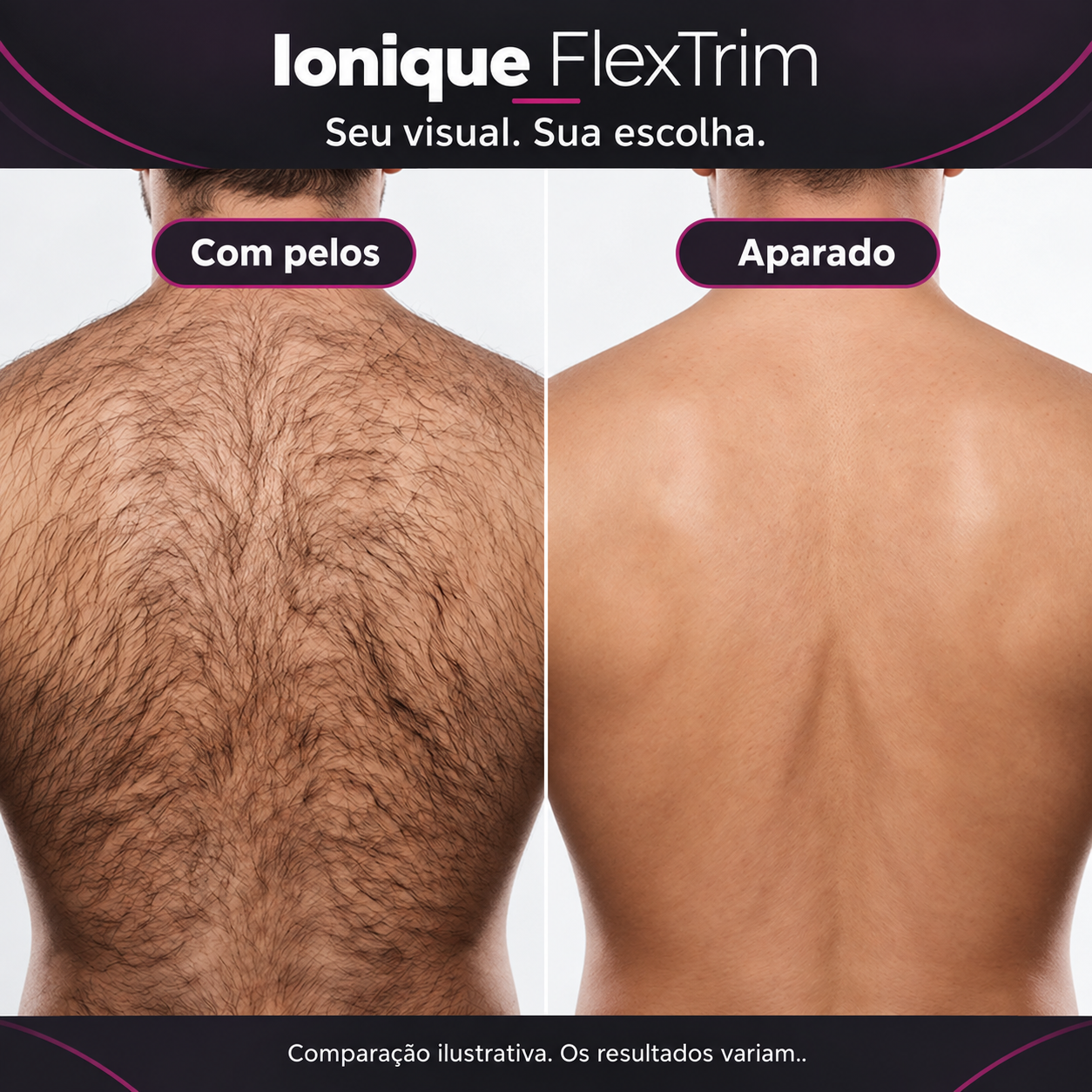 Ionique FlexTrim | Aparador Elétrico de Pelos para Costas e Corpo