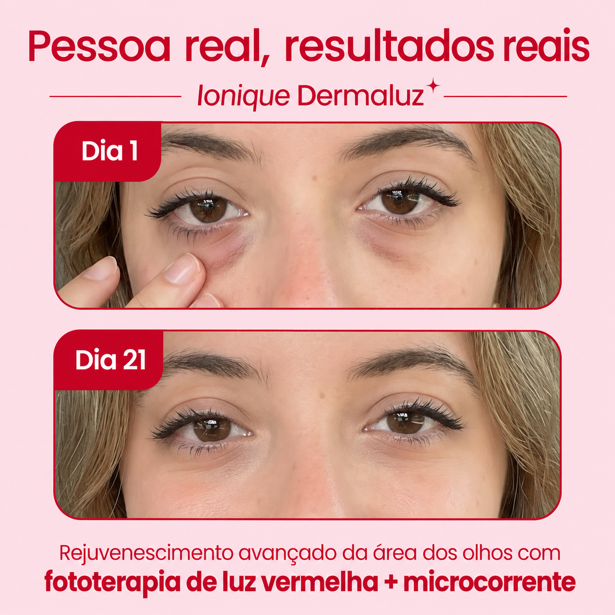 Ionique | Óculos Dermaluz – Microcorrentes & Luz Vermelha para Olheiras e Rugas