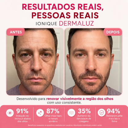 Ionique | Óculos Dermaluz – Microcorrentes & Luz Vermelha para Olheiras e Rugas