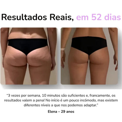 Ionique Velora | Terapia de Contorno Anticelulite Portátil com Ventosas e Ação Térmica