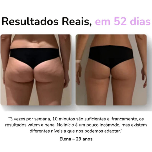 Ionique Velora | Terapia de Contorno Anticelulite | Entrega Full | Portátil com Ventosas e Ação Térmica